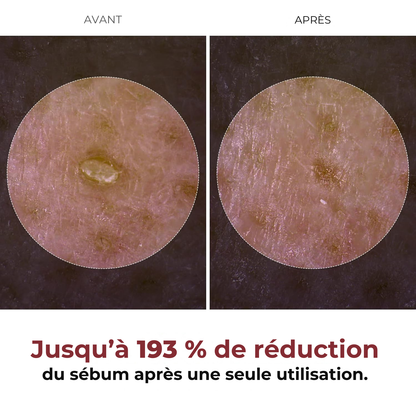 Dr. Melaxin – Peel Shot Glow à base de Riz Noir