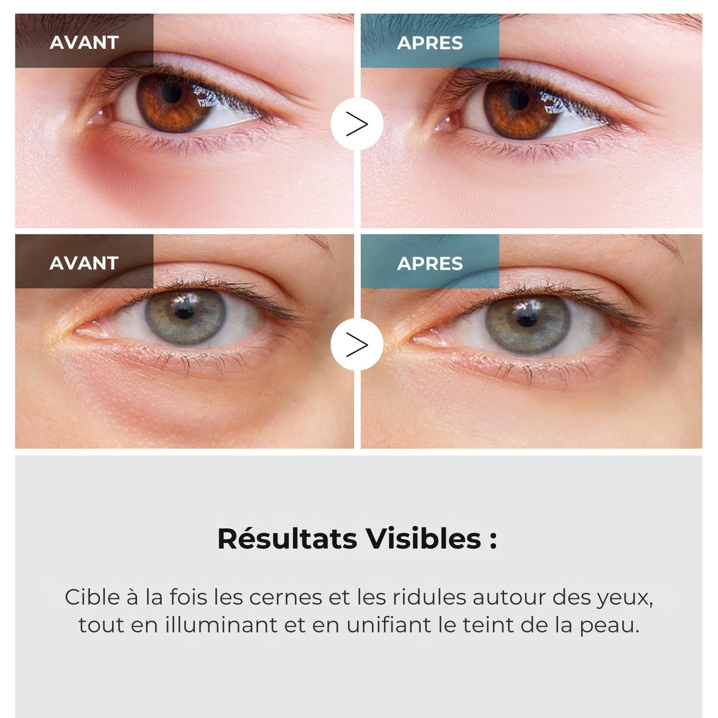 Dr. Melaxin – Crème Yeux Double Action TX à l’Acide Tranexamique & Rétinalsome