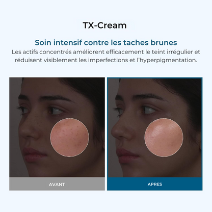 Dr. Melaxin – Crème TX à l’Acide Tranexamique