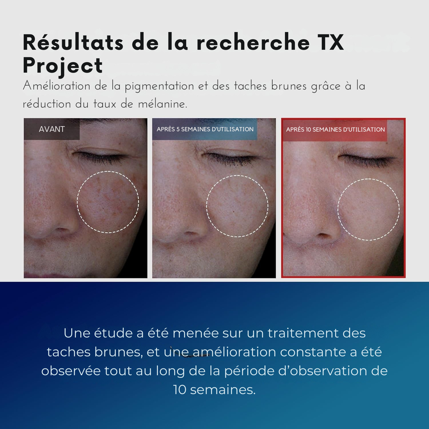 Dr. Melaxin – Ligne de Soin TX à l’Acide Tranexamique