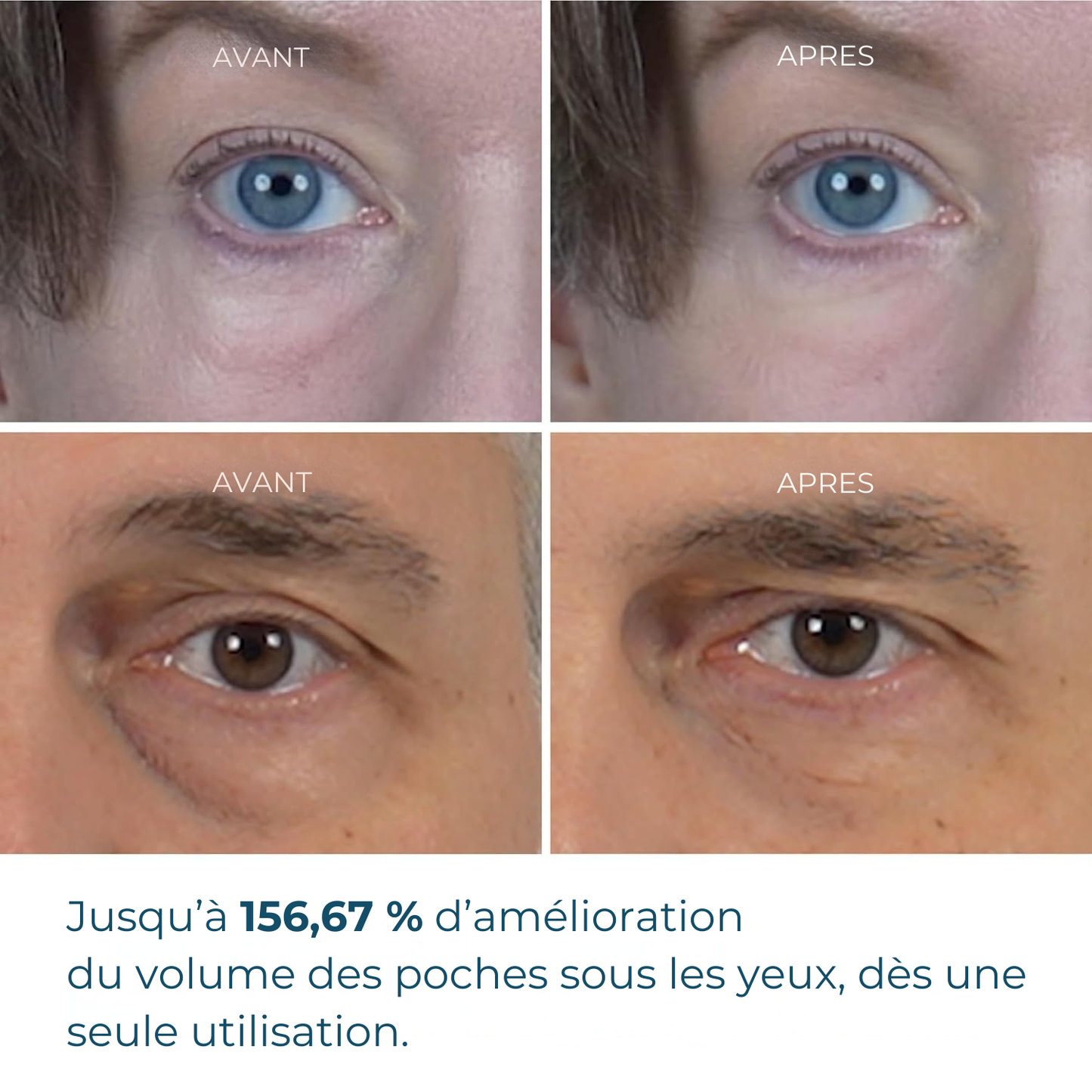 Dr. Melaxin – Eyephalt Crème Anti-Poches & Cernes