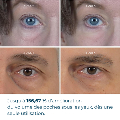 Dr. Melaxin – Eyephalt Crème Anti-Poches & Cernes